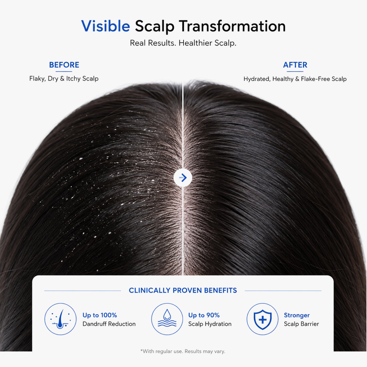 Dermastrix5