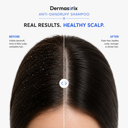 Dermastrix5