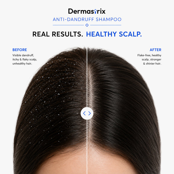 Dermastrix5