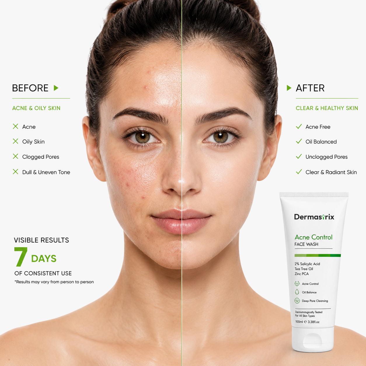 Dermastrix5