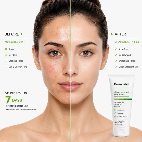 Dermastrix5