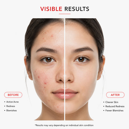 Dermastrix5