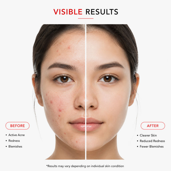 Dermastrix5